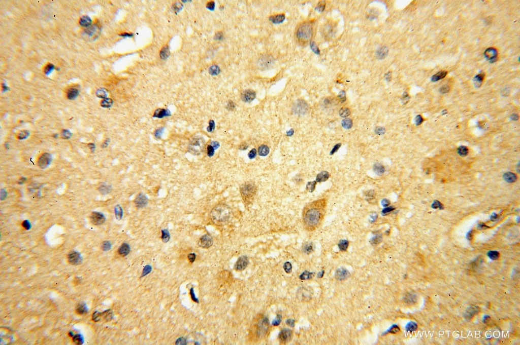 Immunohistochemistry (IHC) staining of human brain tissue using RPL23 Polyclonal antibody (16086-1-AP)