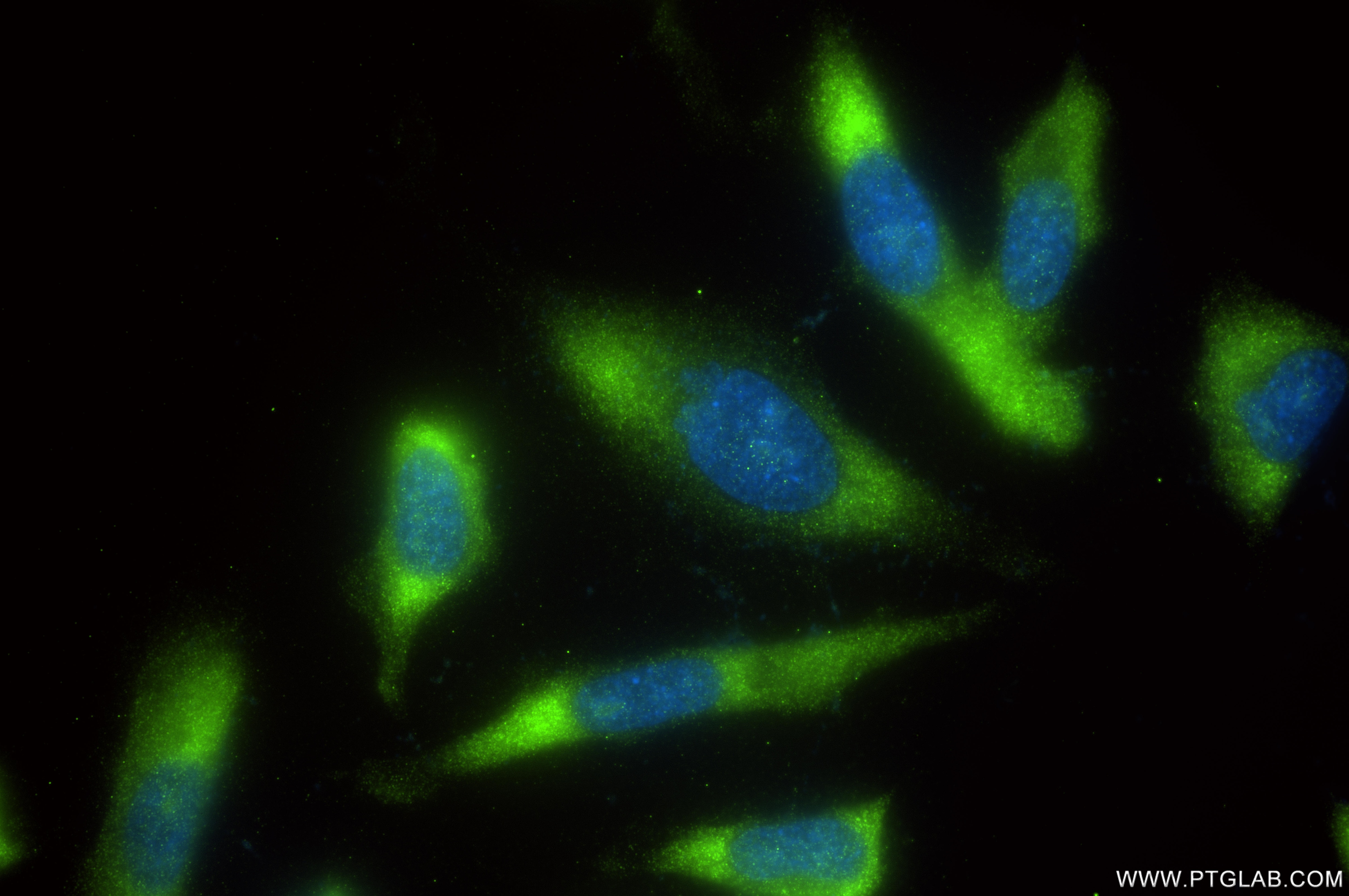 Immunofluorescence (IF) / fluorescent staining of HeLa cells using RPL23 Recombinant antibody (86520-1-RR)