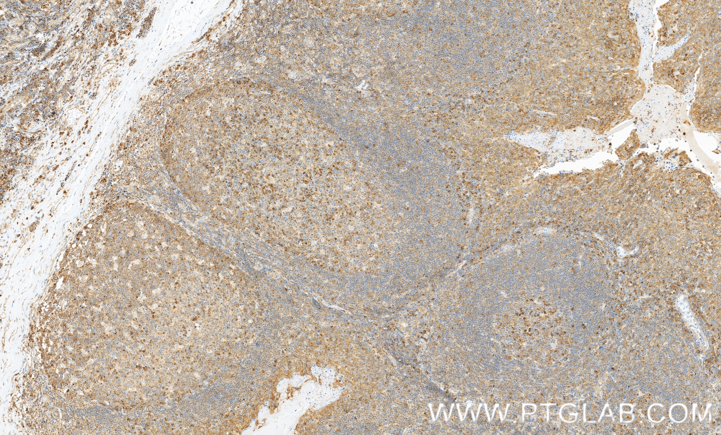 Immunohistochemistry (IHC) staining of human tonsillitis tissue using RPL23 Recombinant monoclonal antibody (86520-1-RR)