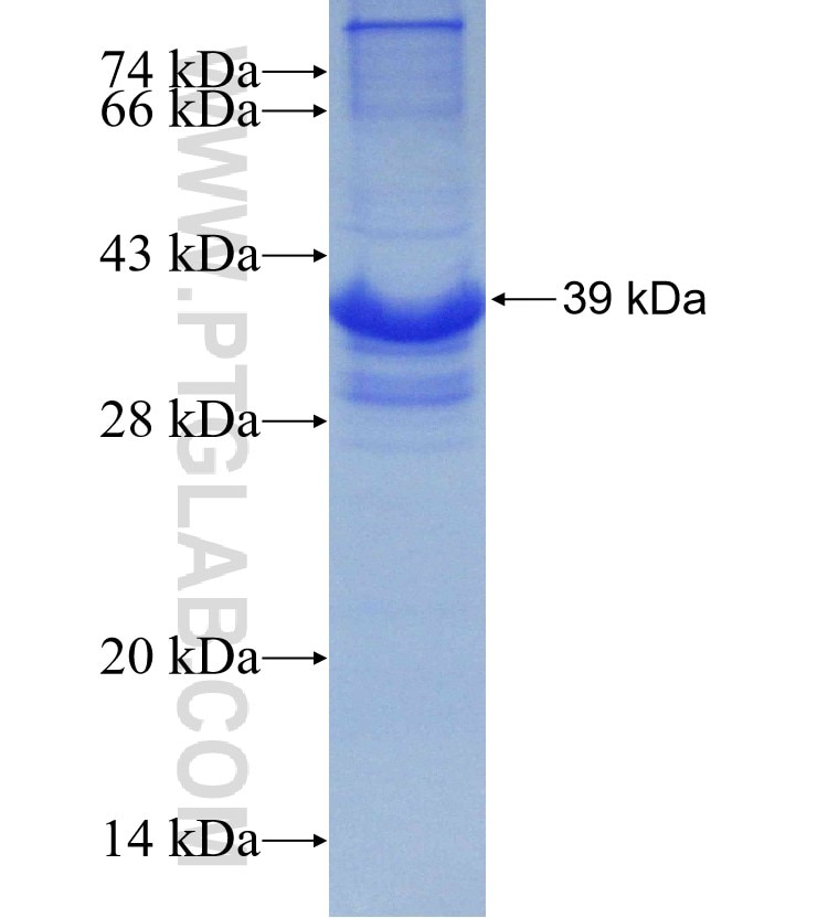 RPL23 fusion protein Ag9120 SDS-PAGE