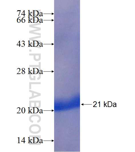 RPL23 fusion protein Ag9438 SDS-PAGE