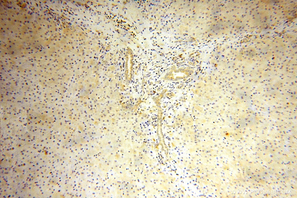 Immunohistochemistry (IHC) staining of human liver tissue using RPL23A Polyclonal antibody (16386-1-AP)
