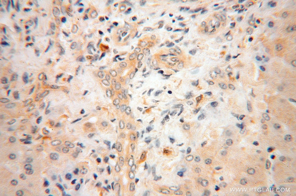 Immunohistochemistry (IHC) staining of human liver tissue using RPL23A Polyclonal antibody (16386-1-AP)