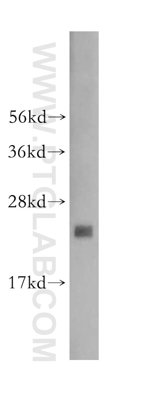 Western Blot (WB) analysis of human liver tissue using RPL23A Polyclonal antibody (16386-1-AP)