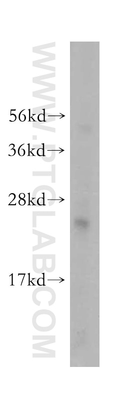 Western Blot (WB) analysis of human heart tissue using RPL23A Polyclonal antibody (16386-1-AP)