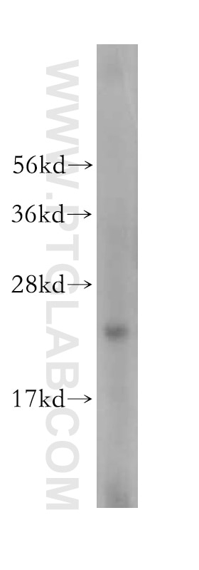 Western Blot (WB) analysis of HeLa cells using RPL23A Polyclonal antibody (16386-1-AP)