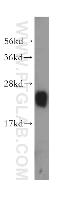 Western Blot (WB) analysis of human liver tissue using RPL23A Polyclonal antibody (16386-1-AP)