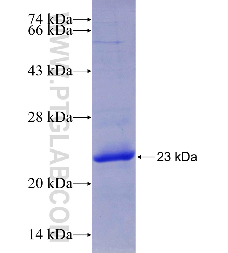 RPL23A fusion protein Ag9424 SDS-PAGE