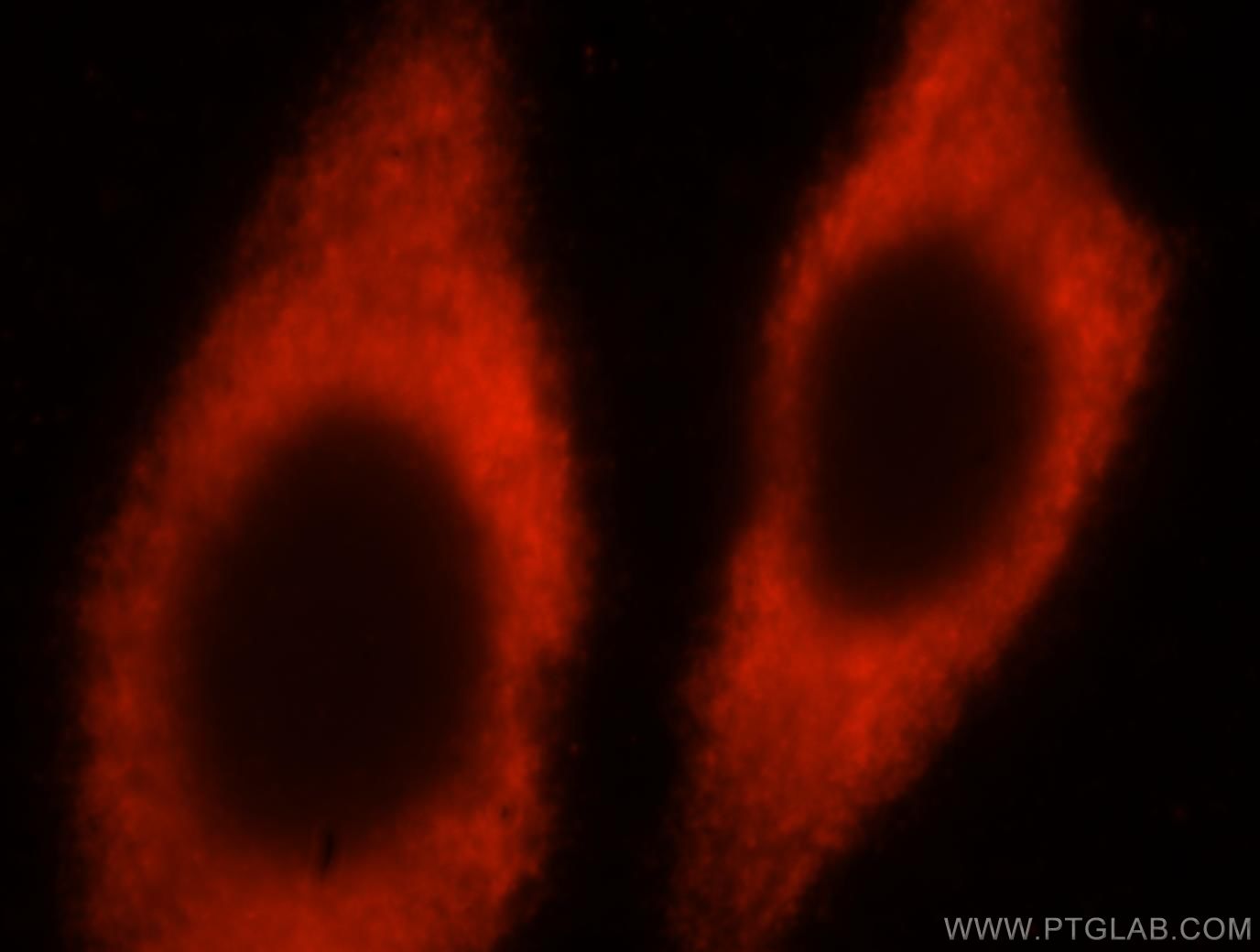 Immunofluorescence (IF) / fluorescent staining of HeLa cells using RPL24 Polyclonal antibody (17082-1-AP)