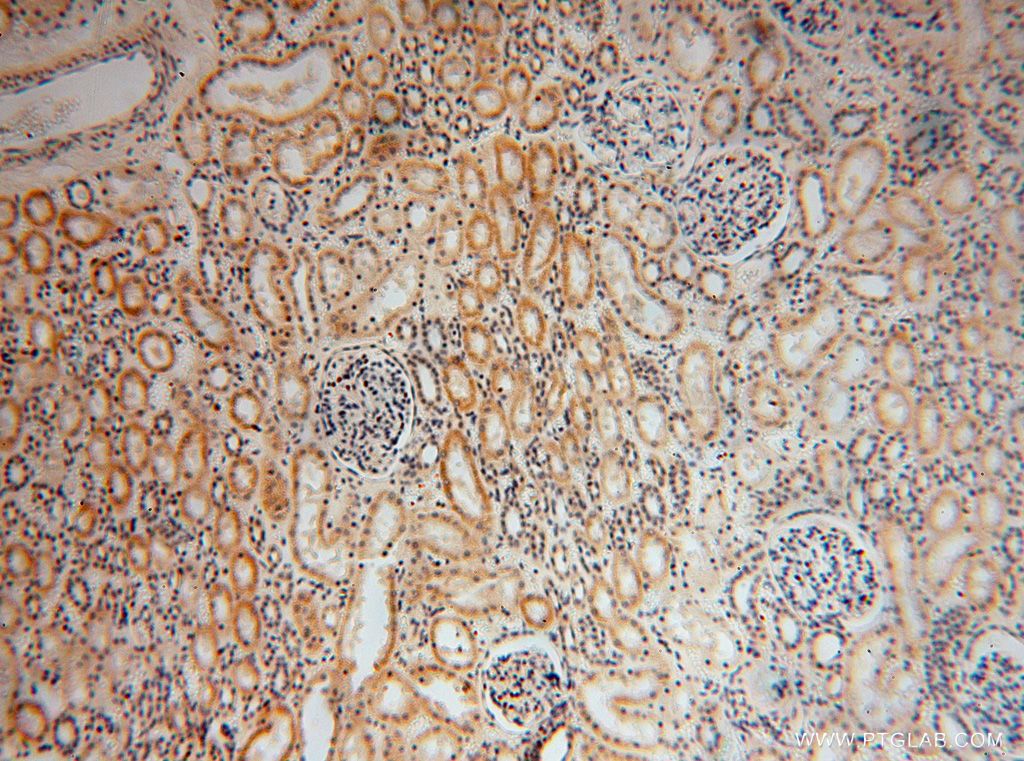 IHC staining of human kidney using 17082-1-AP
