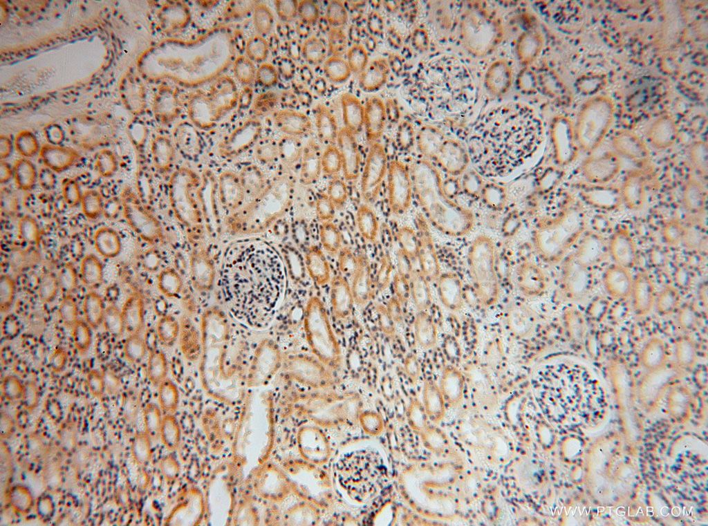 Immunohistochemistry (IHC) staining of human kidney tissue using RPL24 Polyclonal antibody (17082-1-AP)