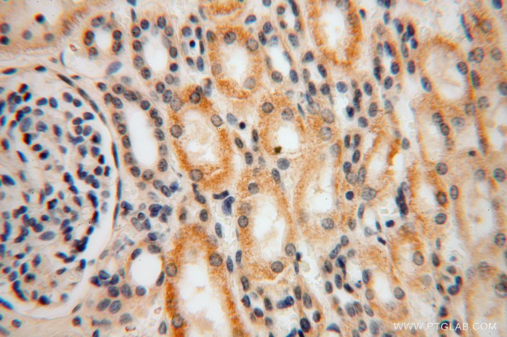 Immunohistochemistry (IHC) staining of human kidney tissue using RPL24 Polyclonal antibody (17082-1-AP)