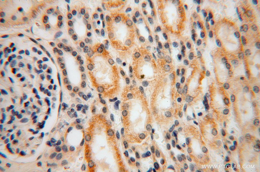 IHC staining of human kidney using 17082-1-AP