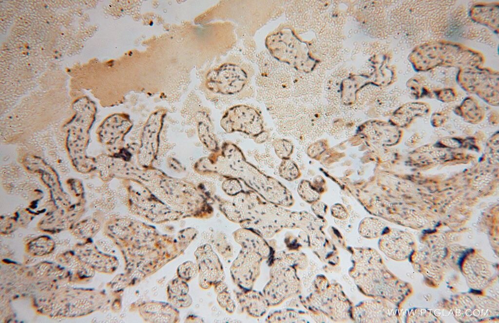 Immunohistochemistry (IHC) staining of human placenta tissue using RPL24 Polyclonal antibody (17082-1-AP)