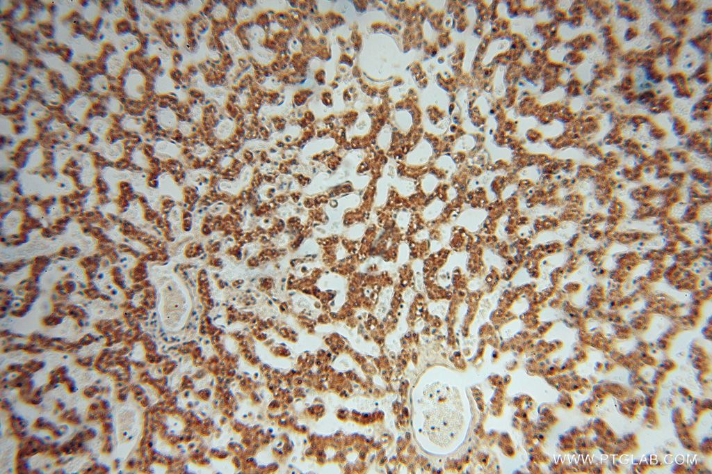 Immunohistochemistry (IHC) staining of human liver tissue using RPL24 Polyclonal antibody (17082-1-AP)