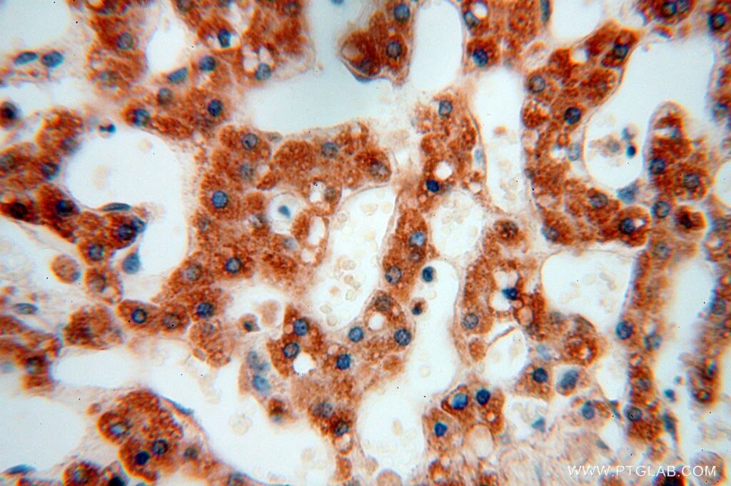 IHC staining of human liver using 17082-1-AP