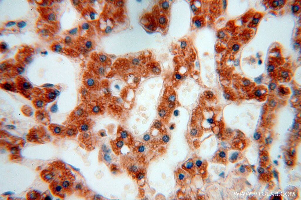 Immunohistochemistry (IHC) staining of human liver tissue using RPL24 Polyclonal antibody (17082-1-AP)