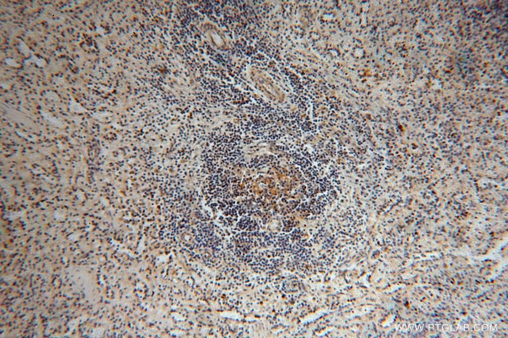 Immunohistochemistry (IHC) staining of human spleen tissue using RPL24 Polyclonal antibody (17082-1-AP)