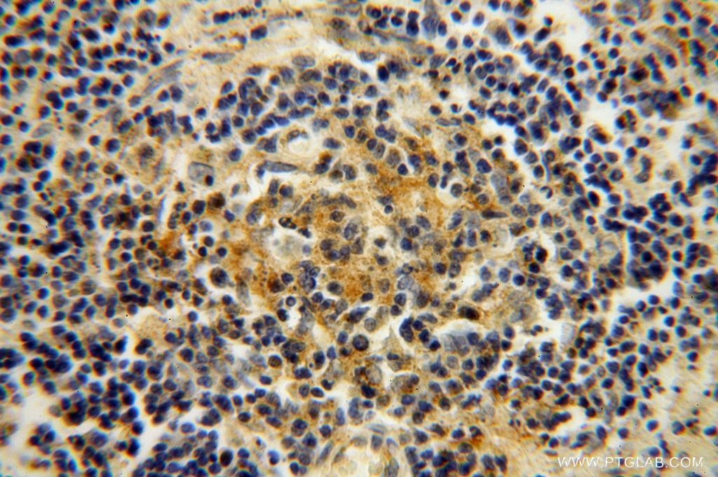 Immunohistochemistry (IHC) staining of human spleen tissue using RPL24 Polyclonal antibody (17082-1-AP)