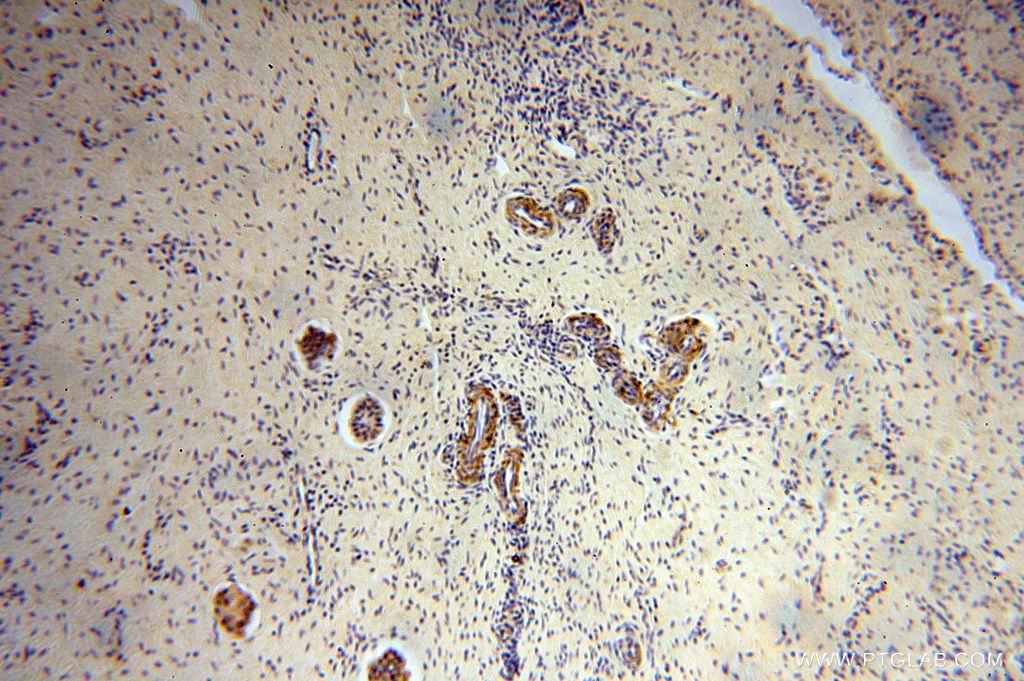 Immunohistochemistry (IHC) staining of human ovary tissue using RPL24 Polyclonal antibody (17082-1-AP)
