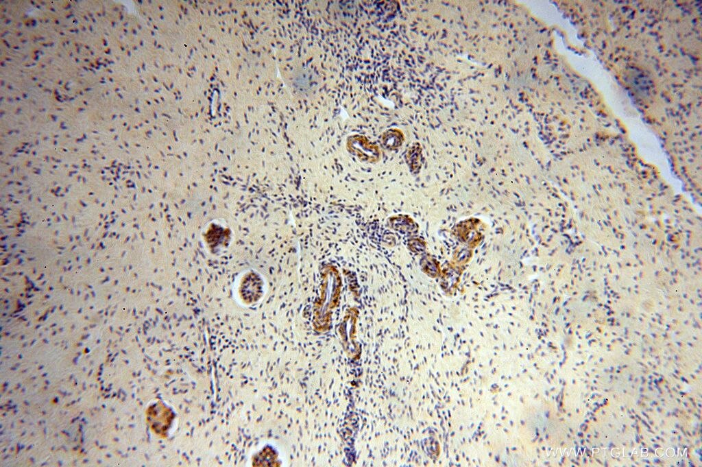 IHC staining of human ovary using 17082-1-AP