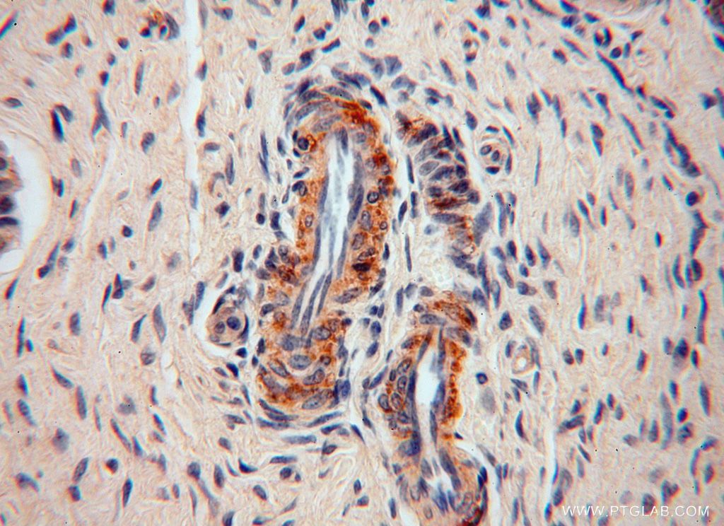Immunohistochemistry (IHC) staining of human ovary tissue using RPL24 Polyclonal antibody (17082-1-AP)
