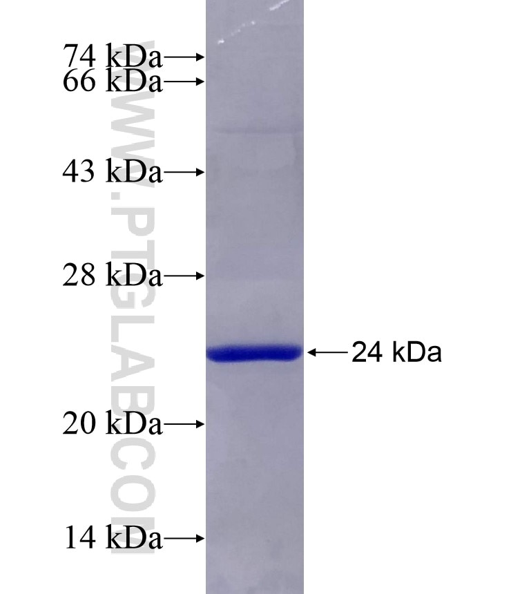RPL24 fusion protein Ag7085 SDS-PAGE
