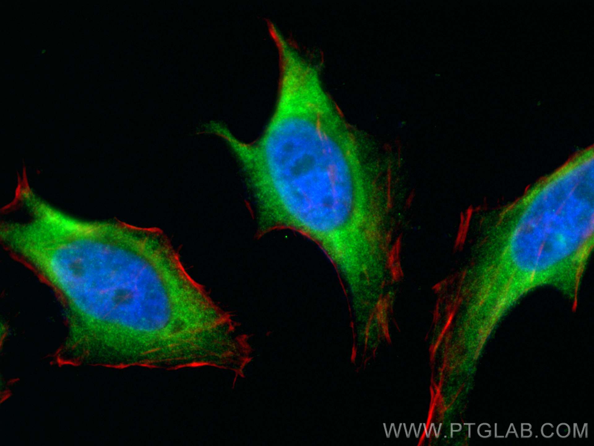 Immunofluorescence (IF) / fluorescent staining of HeLa cells using RPL26 Polyclonal antibody (17619-1-AP)