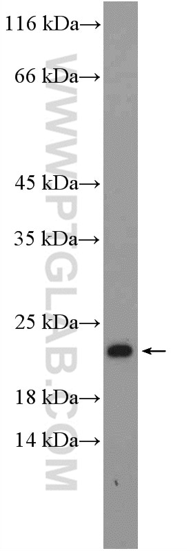 Western Blot (WB) analysis of HeLa cells using RPL26 Polyclonal antibody (17619-1-AP)