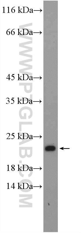 WB analysis of HeLa using 17619-1-AP