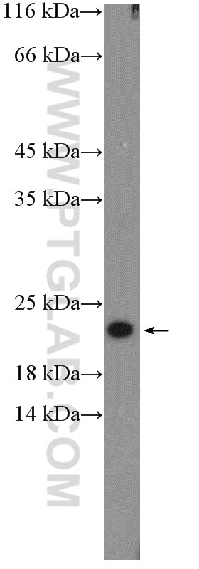 Western Blot (WB) analysis of Jurkat cells using RPL26 Polyclonal antibody (17619-1-AP)