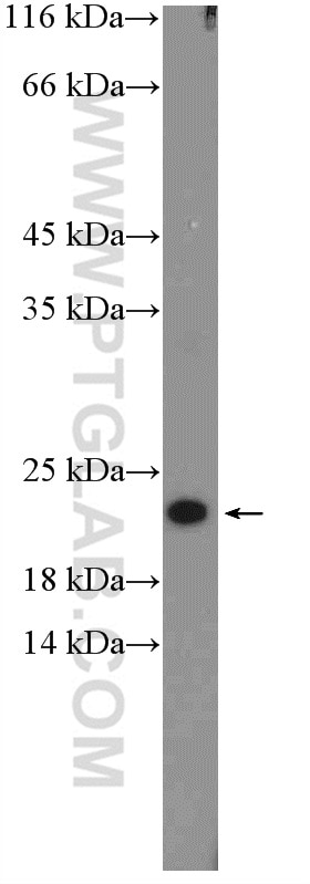 WB analysis of Jurkat using 17619-1-AP