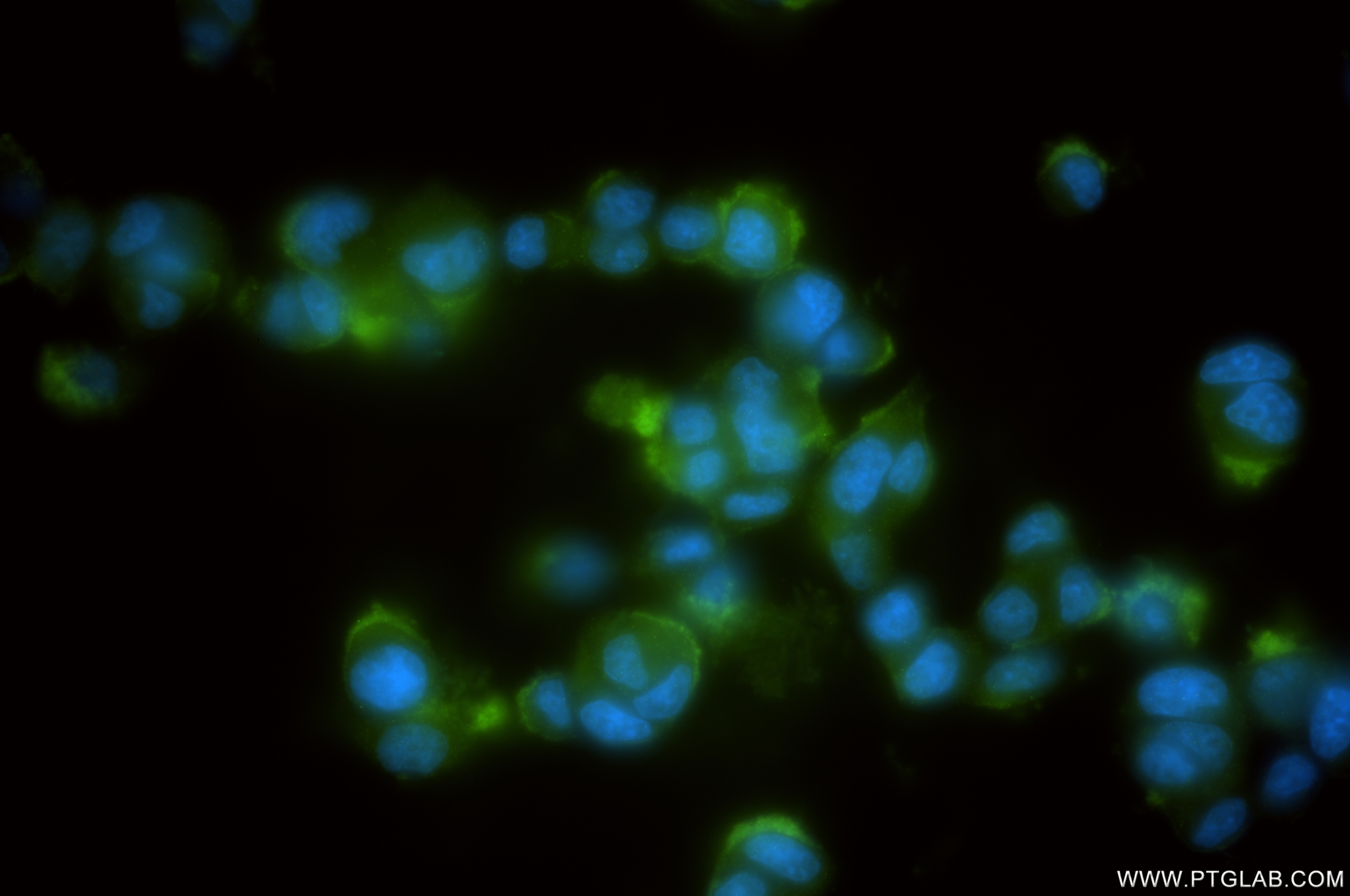 Immunofluorescence (IF) / fluorescent staining of PC-12 cells using RPL26 Recombinant antibody (85775-1-RR)