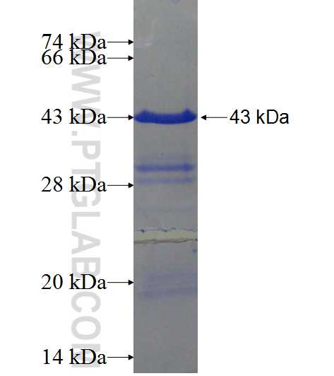 RPL26 fusion protein Ag11821 SDS-PAGE