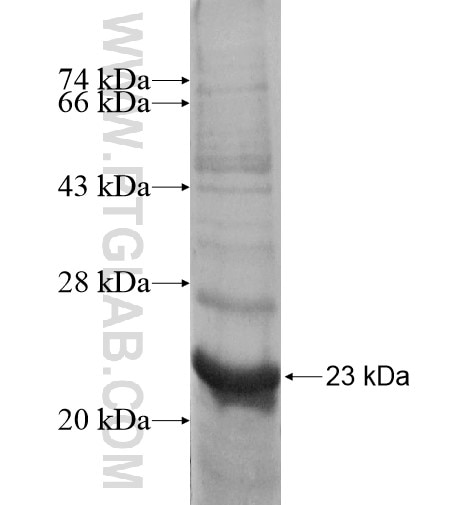 RPL26 fusion protein Ag11934 SDS-PAGE