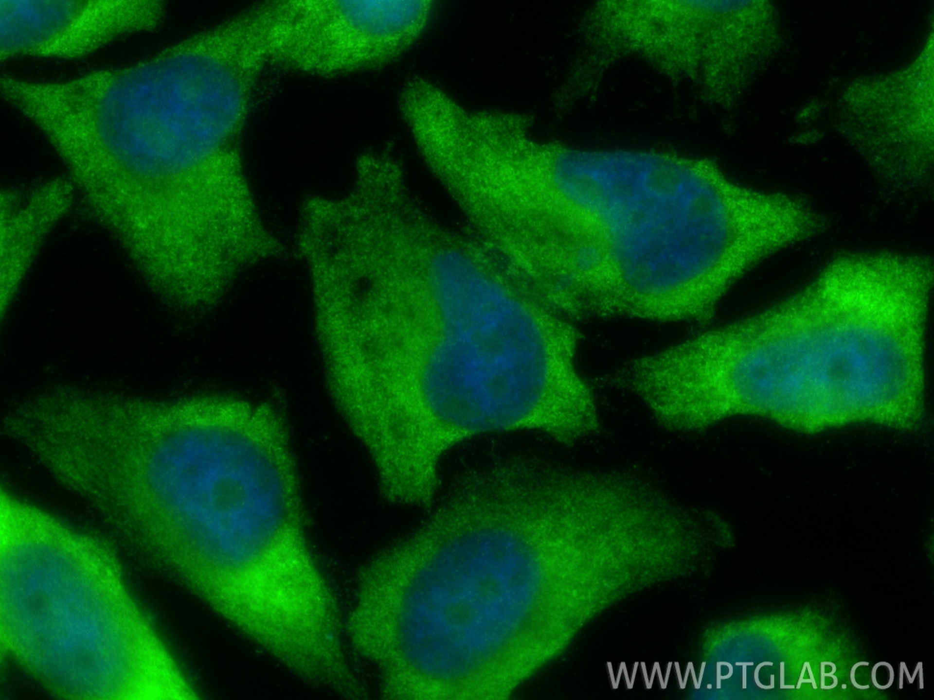 Immunofluorescence (IF) / fluorescent staining of HeLa cells using RPL26L1 Polyclonal antibody (16487-1-AP)