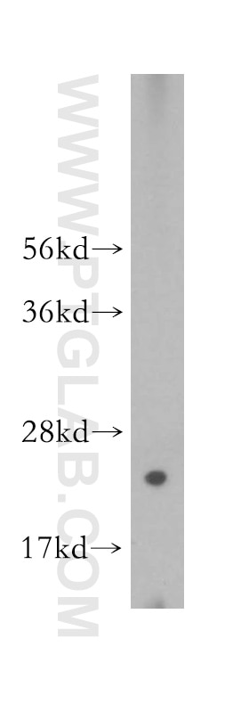 WB analysis of HeLa using 16487-1-AP