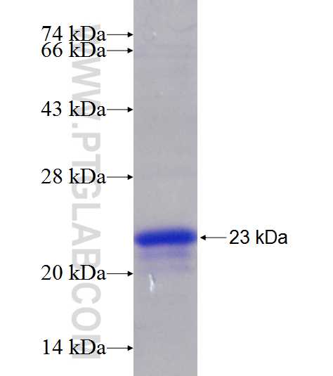 RPL26L1 fusion protein Ag9821 SDS-PAGE
