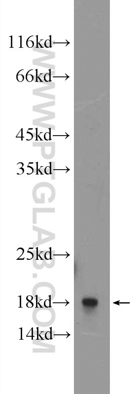 Western Blot (WB) analysis of A549 cells using RPL27A Polyclonal antibody (16002-1-AP)