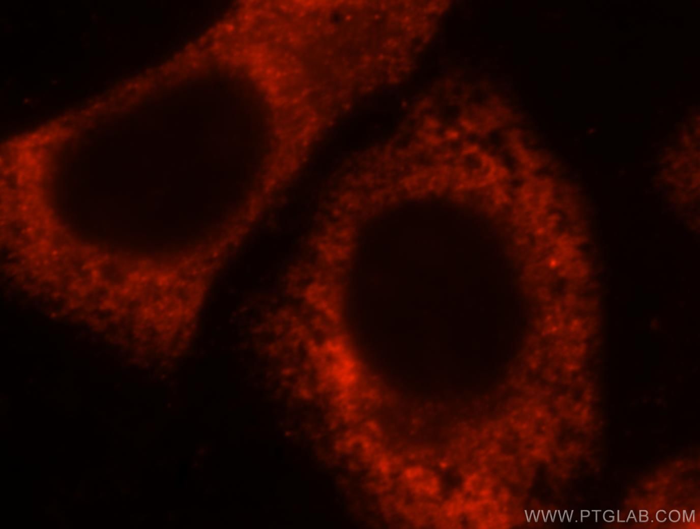 Immunofluorescence (IF) / fluorescent staining of HepG2 cells using RPL28 Polyclonal antibody (16649-1-AP)