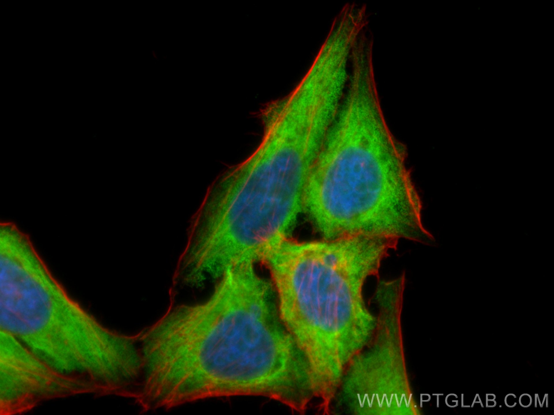 Immunofluorescence (IF) / fluorescent staining of HepG2 cells using RPL29 Polyclonal antibody (15799-1-AP)
