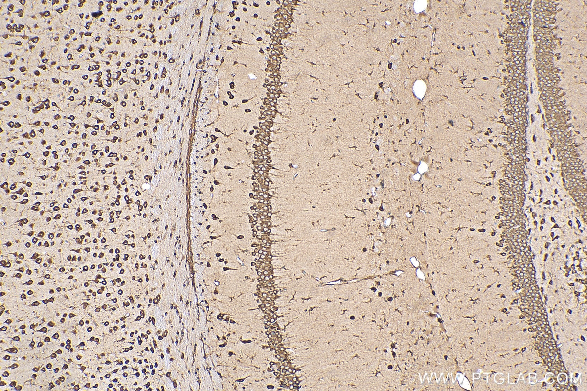 IHC staining of mouse brain using 15799-1-AP