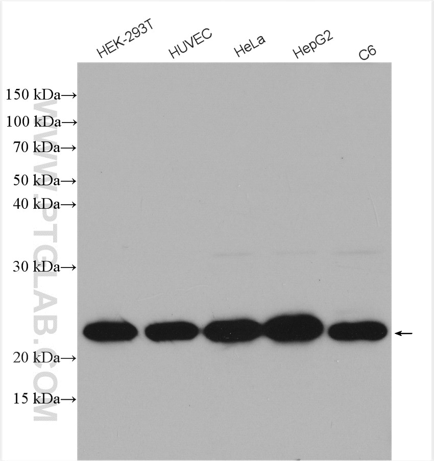 Western Blot (WB) analysis of various lysates using RPL29 Polyclonal antibody (15799-1-AP)