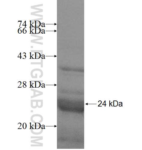 RPL29 fusion protein Ag8379 SDS-PAGE