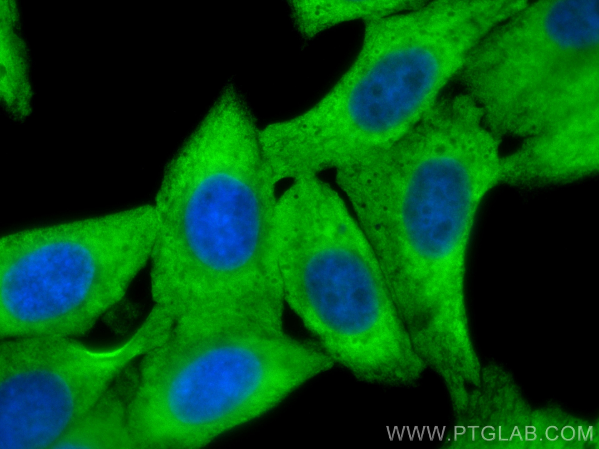 Immunofluorescence (IF) / fluorescent staining of HepG2 cells using RPL3 Polyclonal antibody (11005-1-AP)