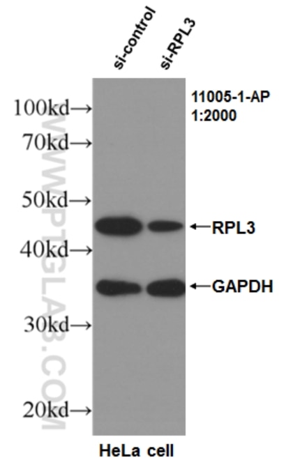 WB analysis of HeLa using 11005-1-AP