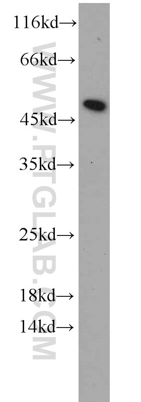 Western Blot (WB) analysis of human kidney tissue using RPL3 Polyclonal antibody (11005-1-AP)