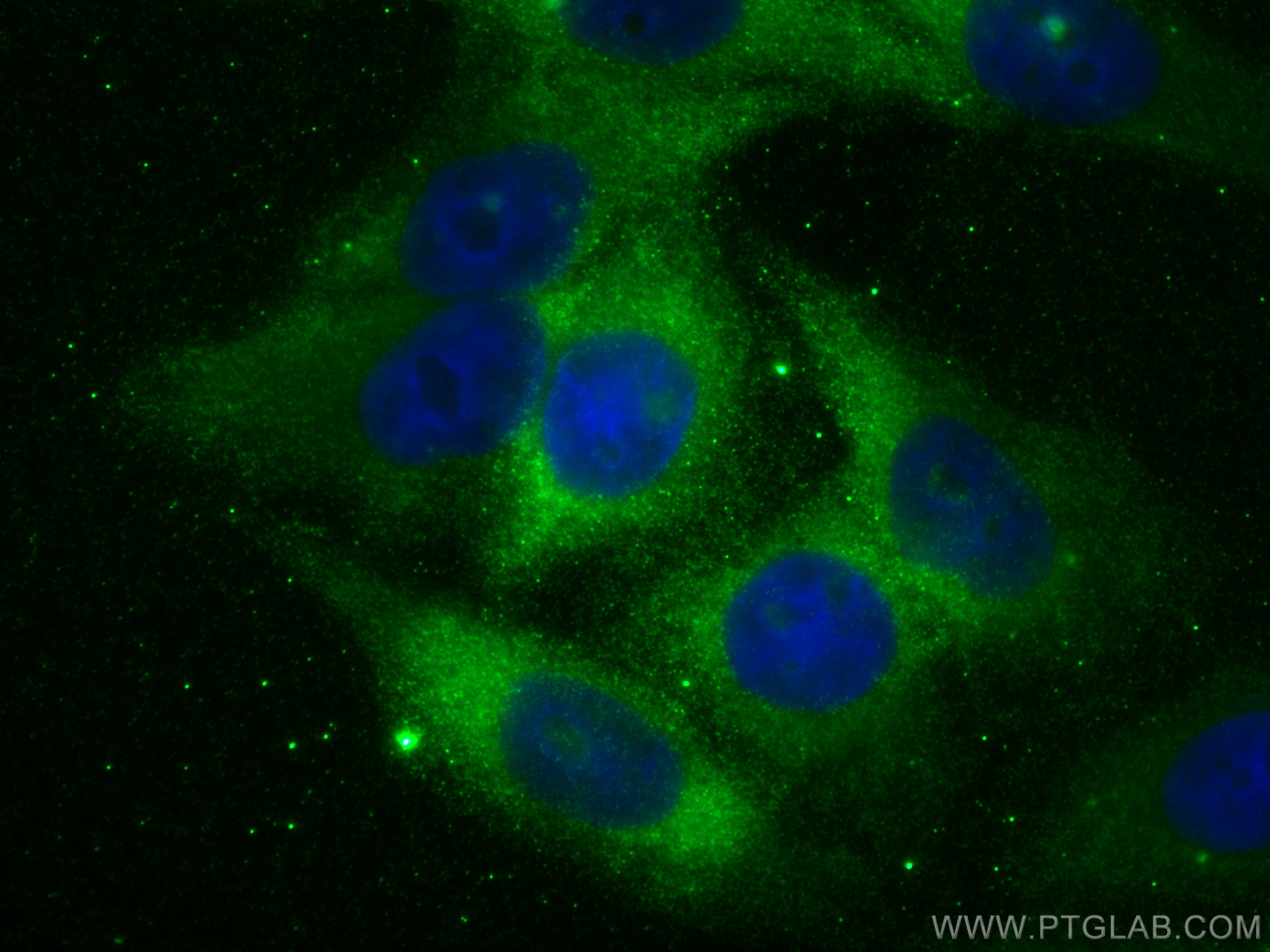 Immunofluorescence (IF) / fluorescent staining of HepG2 cells using RPL3 Monoclonal antibody (66130-1-Ig)