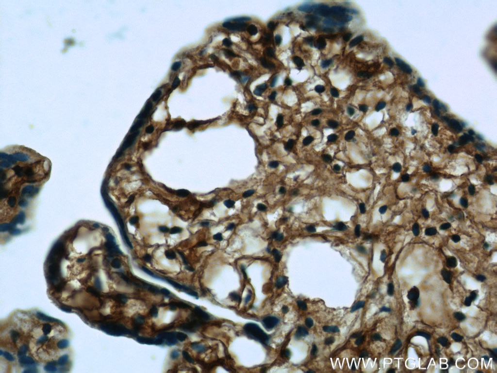 Immunohistochemistry (IHC) staining of human placenta tissue using RPL3 Monoclonal antibody (66130-1-Ig)