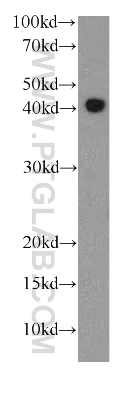 Western Blot (WB) analysis of HeLa cells using RPL3 Monoclonal antibody (66130-1-Ig)